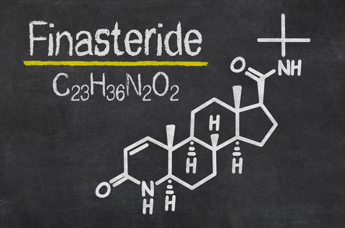 Finasteride