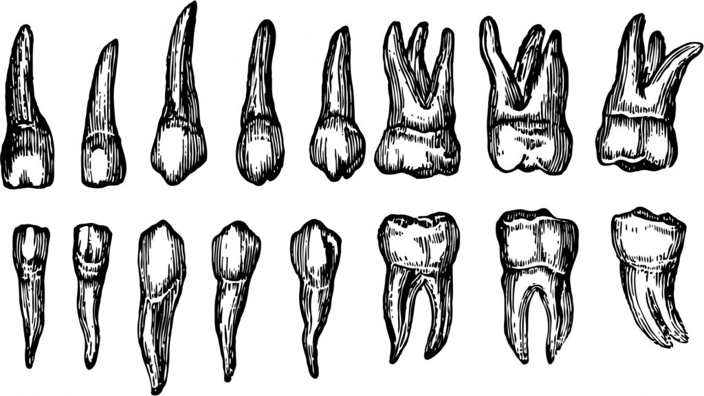 After the Rot Sets In: Teeth on Treatment - RxISK